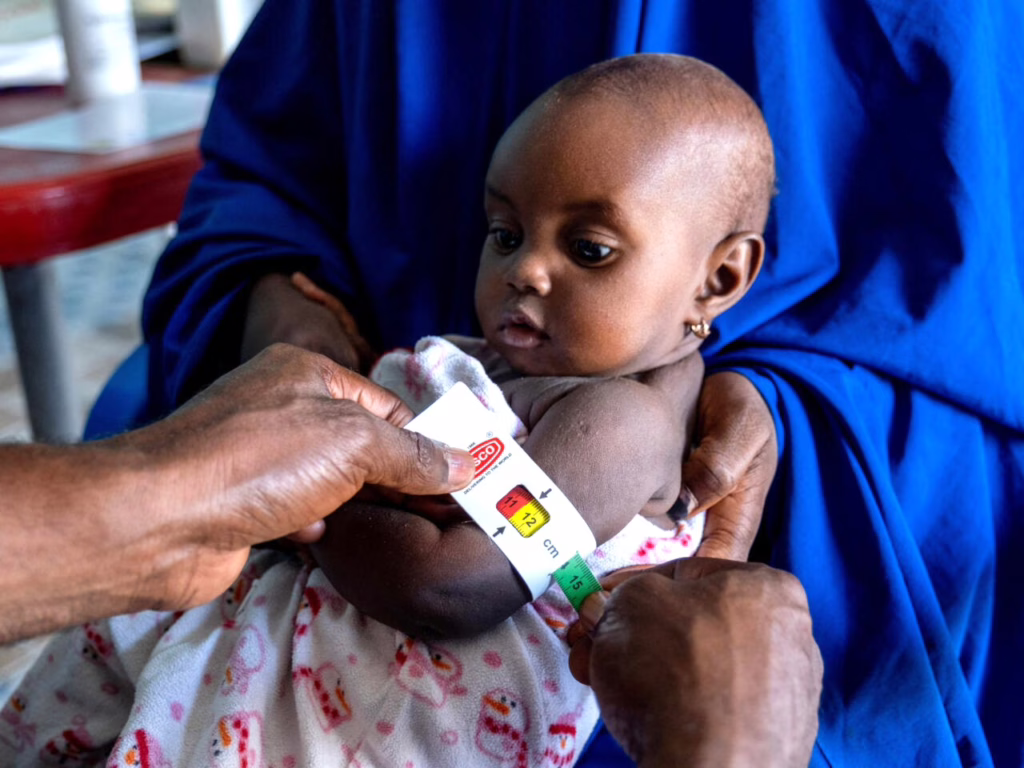 Programmes nutritionnels au Bénin : Un nombre insuffisant d’enfants impactés